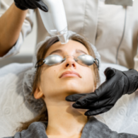 MNRF 2 Chiya Aesthetic Clinic
